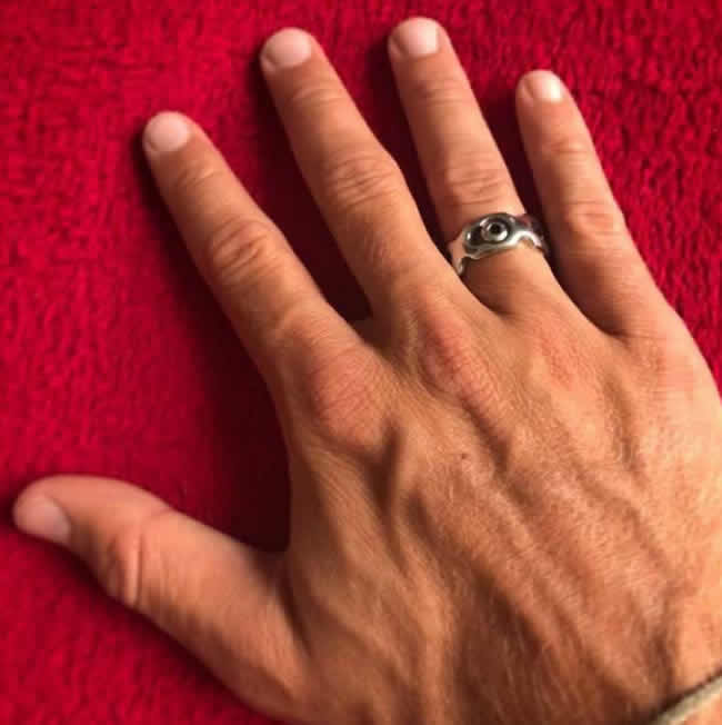 anillo