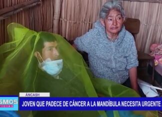 Áncash: Joven que padece de cáncer a la mandíbula necesita urgente ayuda Áncash: Joven que padece de cáncer a la mandíbula necesita urgente ayuda