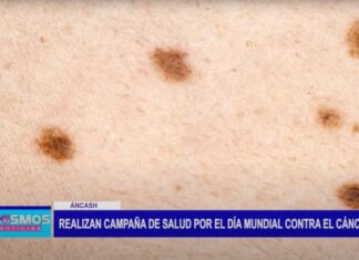 Áncash: Red de Salud Pacífico Norte realizó campaña de salud por el día Mundial Contra el Cáncer