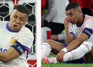 ¡Dura lesión!: Kylian Mbappé podría ser baja para el resto de la Eurocopa